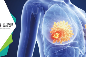 10 Best Exercises For Breast Cancer Patients