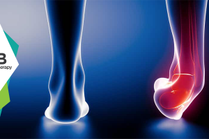 Ankle Sprain | Physiotherapy Management And Prevention.