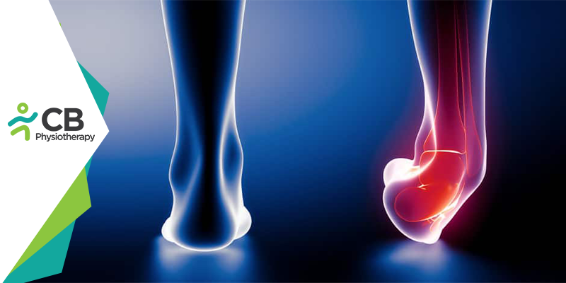 Ankle Sprain | Physiotherapy Management And Prevention.