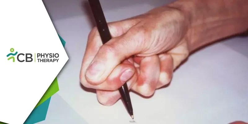 Managing Writer's Hand | The Crucial Role Of Physiotherapy In Alleviating Symptoms