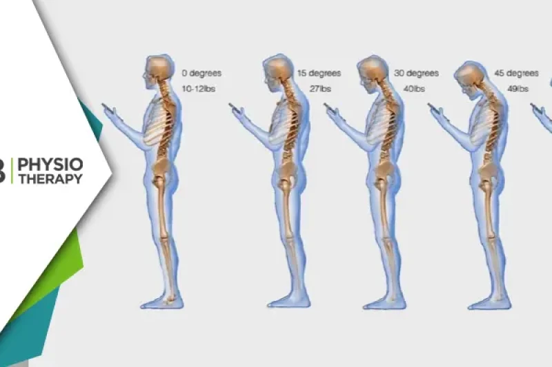 Text Neck Syndrome | How Physiotherapy Can Prevent And Treat This Modern-day Epidemic