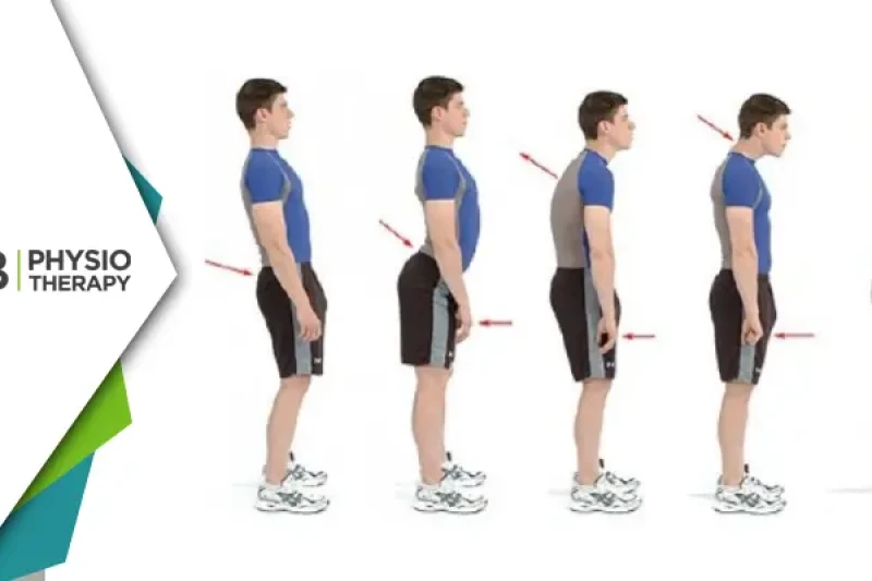 Why Posture Matters | How Physiotherapy Posture Assessment And Correction Can Prevent Chronic Pain And Boost Overall Health