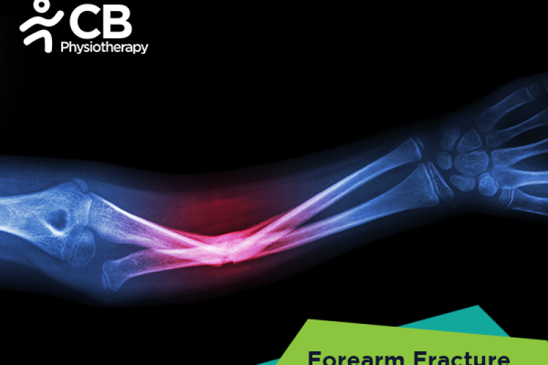 forearm-fractures.webp