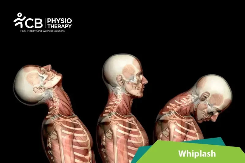 whiplash.webp