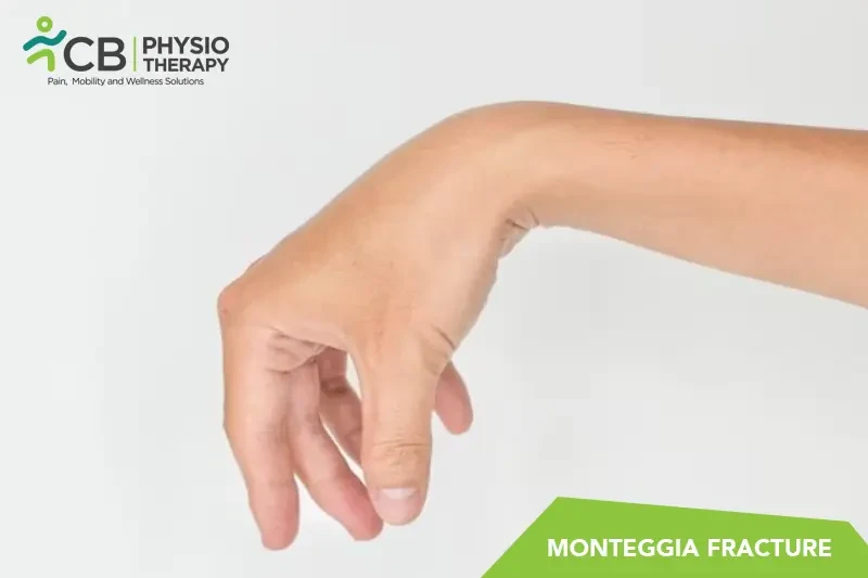 wrist-drop.webp