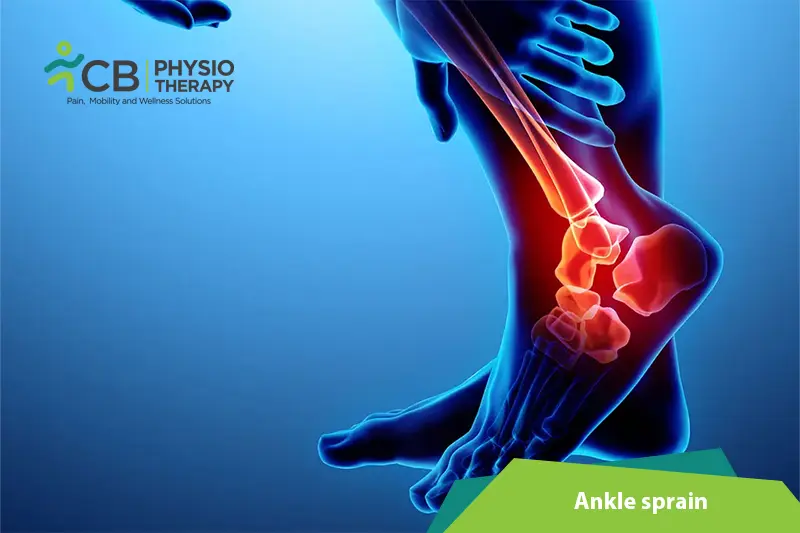 Ankle Sprain