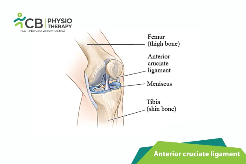 Anterior Cruciate Ligament Tear(acl)