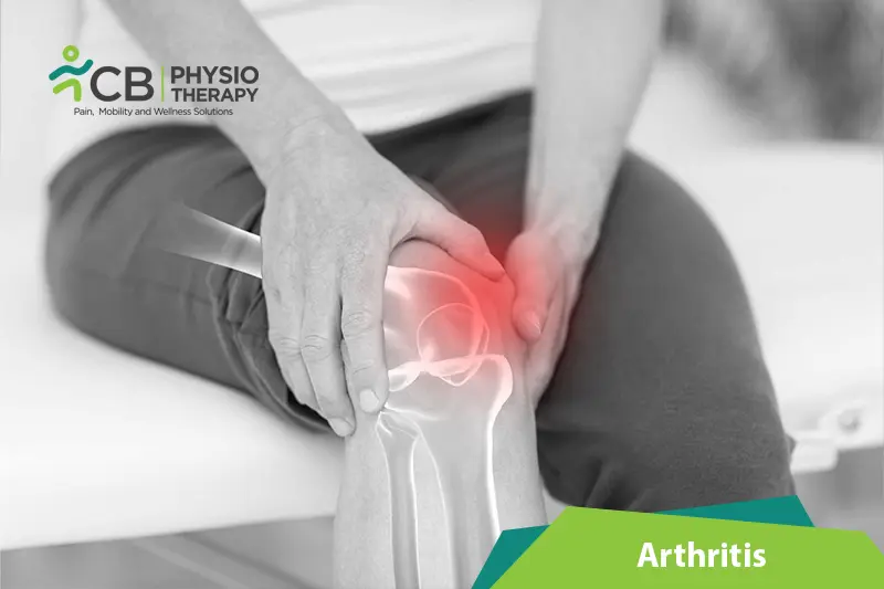 Arthritis