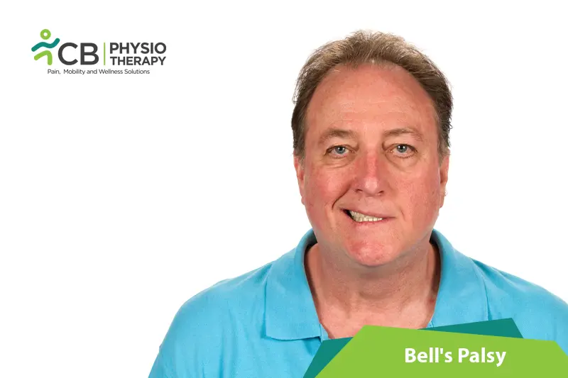 Bell's Palsy Or Facial Palsy