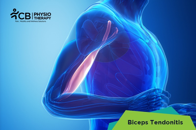 Biceps Tendonitis