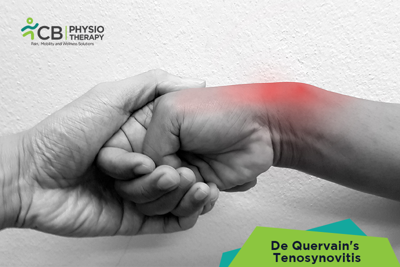 De Quervain's Tenosynovitis