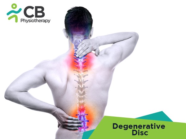 Degenerative Disc Disease