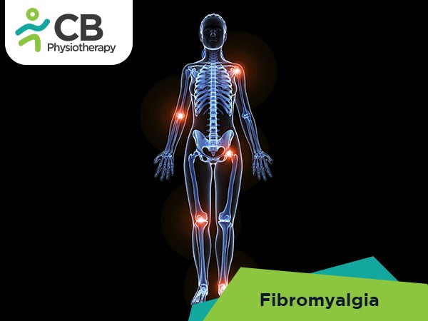 Fibromyalgia Syndrome