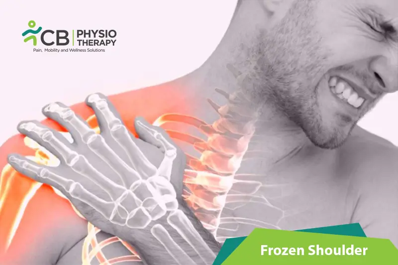Frozen Shoulder