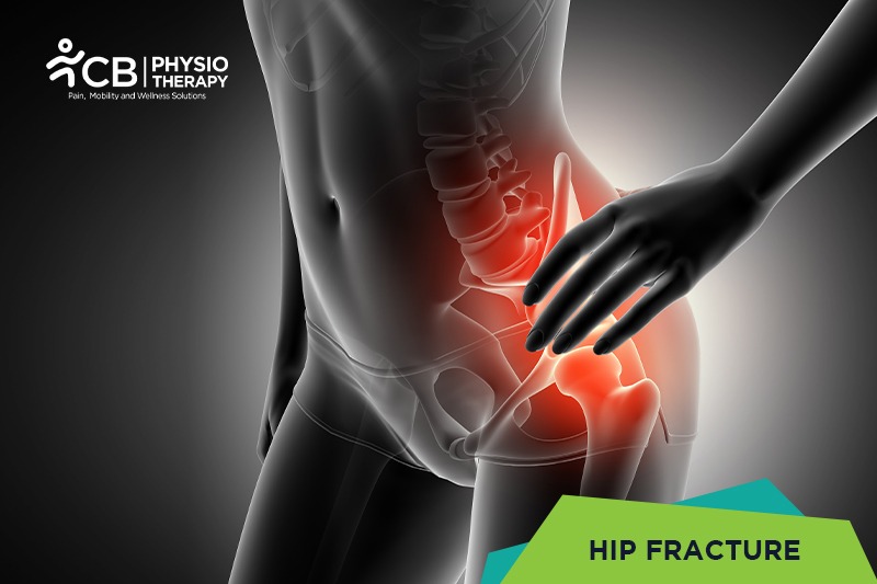 Hip Fracture