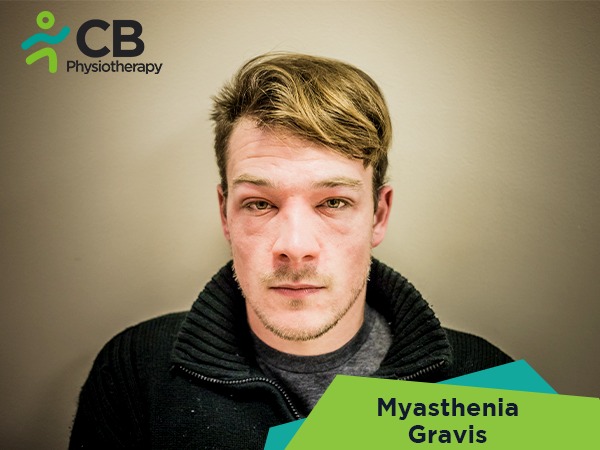 Myasthenia Gravis (mg)