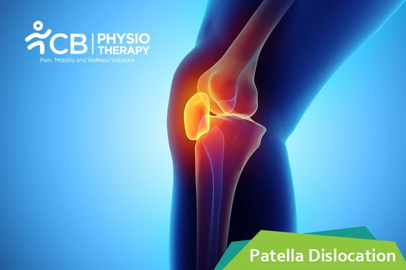 Patella Dislocation