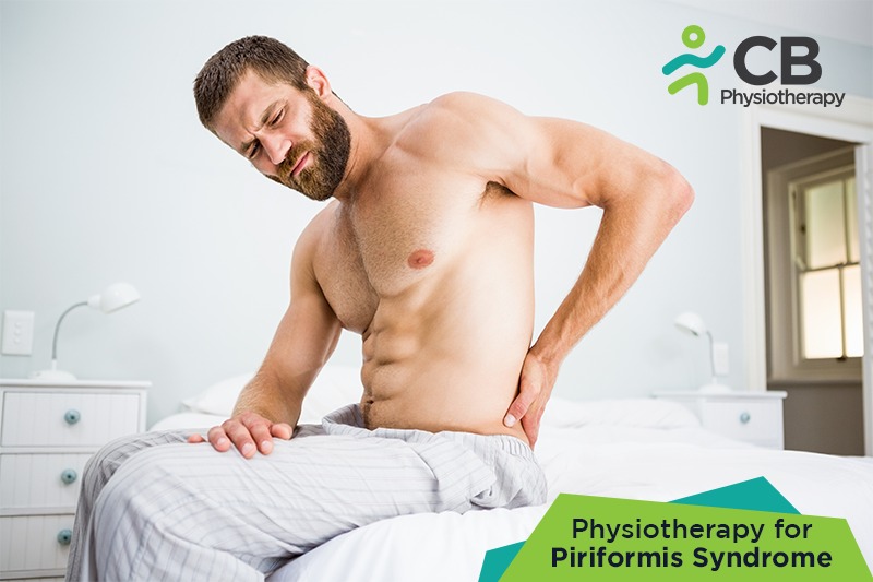 Piriformis Syndrome