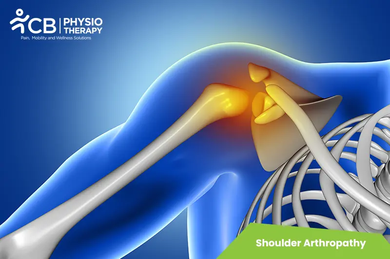 Shoulder Arthropathy