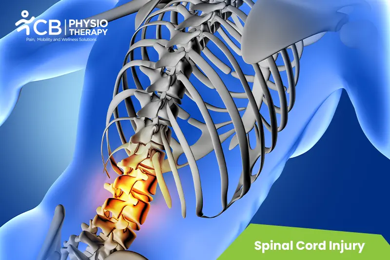 Spinal Cord Injury