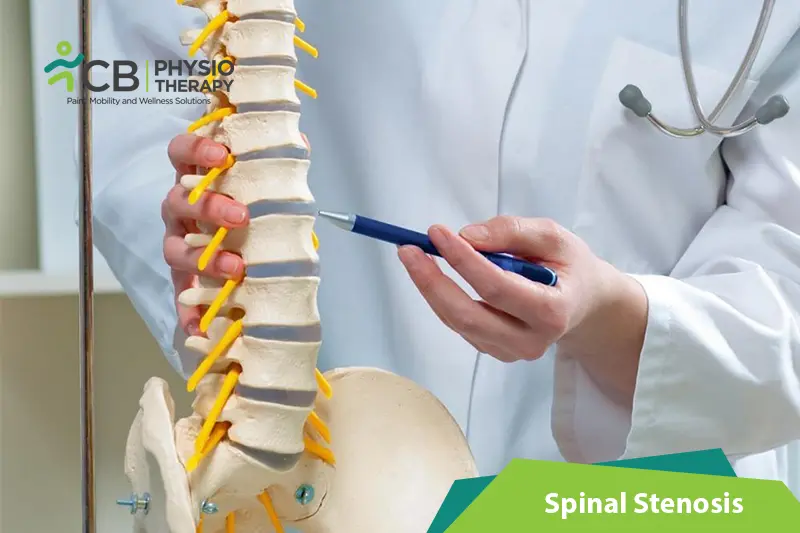 Spinal Stenosis