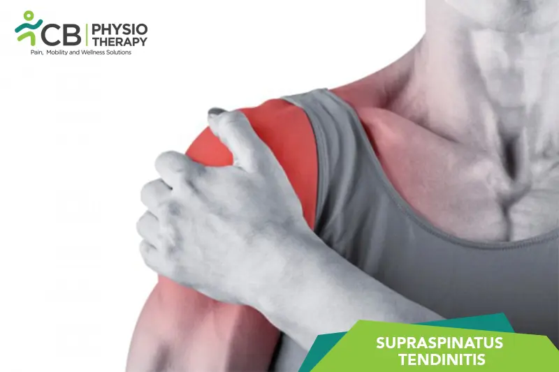 Supraspinatus Tendinitis
