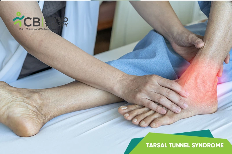Tarsal Tunnel Syndrome