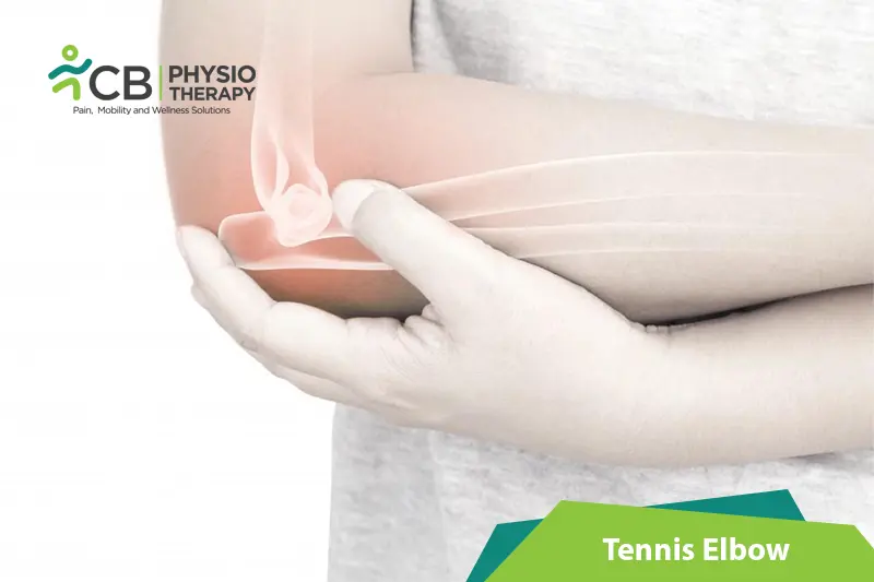 Tennis Elbow